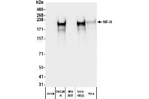 Western Blotting (WB) image for Mouse anti-Chicken IgY Light Chain (Light Chain) antibody (ABIN7795616)