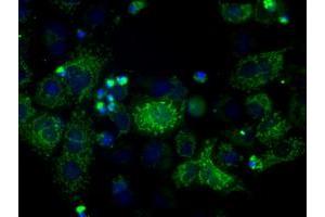 Image no. 10 for anti-ATP Synthase, H+ Transporting, Mitochondrial F1 Complex, beta Polypeptide (ATP5B) antibody (ABIN1496766) (ATP5B antibody)