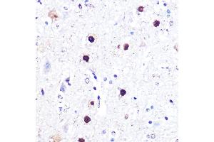 Immunohistochemistry of paraffin-embedded mouse spinal cord using  Rabbit pAb  at dilution of 1:100 (40x lens). (ATF2 antibody)