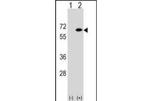 Western blot analysis of EYA2 (arrow) using rabbit polyclonal EYA2 Antibody (Center) (ABIN1538098 and ABIN2848741). (EYA2 antibody  (AA 216-244))