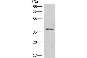 Western blot analysis of NIH/3T3 cell lysate using HOXD9 Polyclonal Antibody at dilution of 1:1000