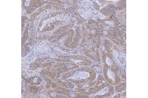 IHC analysis of WDR44 using anti-WDR44 antibody (ABIN7600394). (WDR44 antibody  (AA 188-913))
