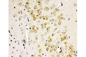 IHC-P: GLUR2 antibody testing of rat brain tissue (GRIA2 antibody  (AA 25-360))