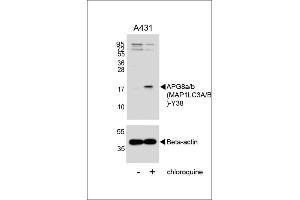 Western blot analysis of lysates from A431 cell line, untreated or treated with chloroquine , 100 ng/mL, using G8a/b (M1LC3A/B) Antibody (Y38) 1803A (upper) or Beta-actin (lower).