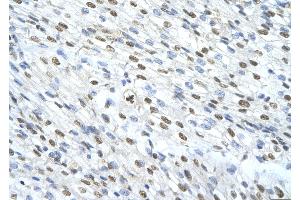 Immunohistochemistry (IHC) image for anti-Matrin 3 (MATR3) (N-Term) antibody (ABIN2779141)
