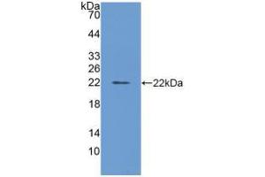 Figure. (FTL antibody  (AA 1-175))
