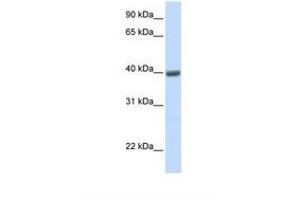 Image no. 1 for anti-Melanoma Antigen Family A, 1 (Directs Expression of Antigen MZ2-E) (MAGEA1) (AA 38-87) antibody (ABIN6749734) (MAGEA1 antibody  (AA 38-87))