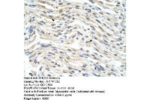 Rabbit Anti-THOC3 Antibody  Paraffin Embedded Tissue: Human Heart Cellular Data: Myocardial cells Antibody Concentration: 4. (THO Complex 3 antibody  (Middle Region))