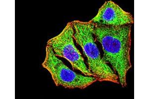 Immunocytochemistry (ICC) image for anti-Superoxide Dismutase 2, Mitochondrial (SOD2) (AA 1-222) antibody (ABIN5888812) (SOD2 antibody  (AA 1-222))