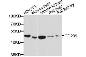 Western blot analysis of extracts of various cell lines, using CD209 antibody. (DC-SIGN/CD209 antibody  (AA 265-404))