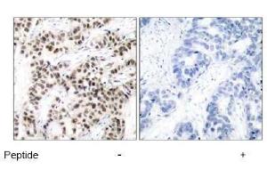 Image no. 2 for anti-Myc Proto-Oncogene protein (MYC) (Thr58) antibody (ABIN197155) (c-MYC antibody  (Thr58))