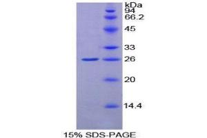 SDS-PAGE (SDS) image for Glutathione S-Transferase kappa 1 (GSTK1) (AA 20-214) protein (His tag) (ABIN2125008)