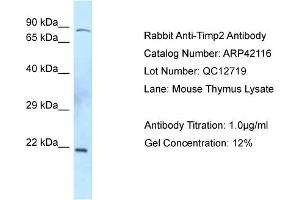 WB Suggested Anti-Timp2 Antibody  Titration: 0. (TIMP2 antibody  (C-Term))
