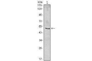 Western Blot showing NFKBIB antibody used against Jurkat (1) cell lysate. (NFKBIB antibody)