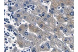 Detection of β-catenin in Human Liver Tissue using Polyclonal Antibody to Beta Catenin (β-catenin) (beta Catenin antibody  (AA 439-675))