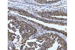 IHC analysis of CSNK2K2 using anti-CSNK2K2 antibody (ABIN7602871). (CSNK2A2 antibody  (C-Term))