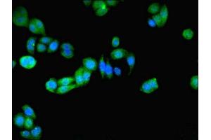 Immunofluorescent analysis of PC-3 cells using ABIN7162944 at dilution of 1:100 and Alexa Fluor 488-congugated AffiniPure Goat Anti-Rabbit IgG(H+L) (Peroxiredoxin 5 antibody  (AA 53-214))