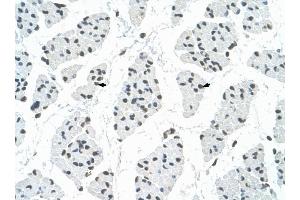 RBM22 antibody was used for immunohistochemistry at a concentration of 4-8 ug/ml to stain Skeletal muscle cells (arrows) in Human Muscle. (RBM22 antibody  (C-Term))