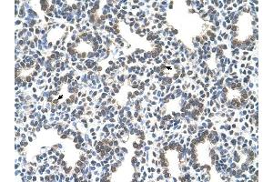 SLC43A3 antibody was used for immunohistochemistry at a concentration of 4-8 ug/ml to stain Alveolar cells (arrows) in Human Lung. (SLC43A3 antibody  (N-Term))