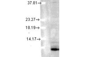 SMC 171, Ubiquitin (6C11 B3), human cvell line mix copy. (Ubiquitin antibody)