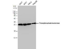 WB Image Triosephosphate isomerase antibody detects Triosephosphate isomerase protein by western blot analysis.
