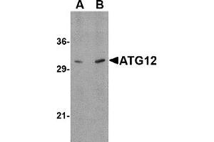 Western Blotting (WB) image for anti-Autophagy Related 12 (ATG12) (N-Term) antibody (ABIN1031244) (ATG12 antibody  (N-Term))