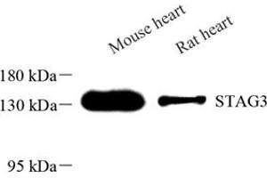 Western blot analysis of STAG3 (ABIN7075744) at dilution of 1: 600 (STAG3 antibody)