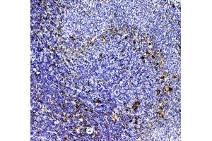 Immunohistochemistry (IHC) image for anti-CD8a Molecule (CD8A) (AA 28-196) antibody (ABIN5693154)