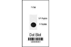Dot Blot (DB) image for anti-Nuclear Factor of kappa Light Polypeptide Gene Enhancer in B-Cells Inhibitor, alpha (NFKBIA) (pSer32) antibody (ABIN3032050)