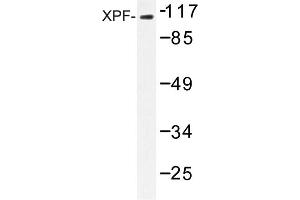 Image no. 1 for anti-Excision Repair Cross-Complementing Rodent Repair Deficiency, Complementation Group 4 (ERCC4) antibody (ABIN272306) (ERCC4 antibody)