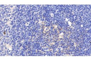 Detection of VCAM1 in Rat Spleen Tissue using Polyclonal Antibody to Vascular Cell Adhesion Molecule 1 (VCAM1) (VCAM1 antibody  (AA 369-658))