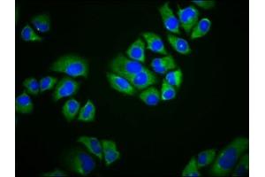 Immunofluorescence staining of Hela cells with ABIN7169831 at 1:166, counter-stained with DAPI. (SCIMP antibody  (AA 59-145))