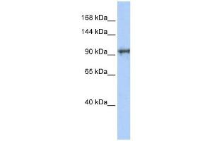CCDC52 antibody used at 1 ug/ml to detect target protein. (SPICE1 antibody  (N-Term))