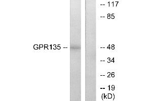 Western blot analysis of extracts from NIH-3T3 cells, using GPR135 antibody. (GPR135 antibody  (Internal Region))
