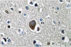 Immunohistochemistry analysis of AKAP149 Antibody in paraffin-embedded human brain tissue. (AKAP1 antibody)