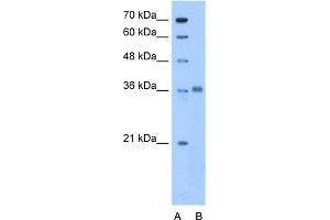 WB Suggested Anti-ALDOC Antibody Titration:  0. (ALDOC antibody  (N-Term))