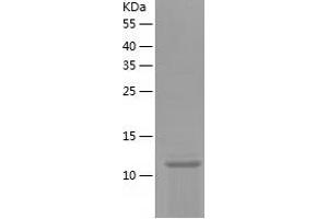 Western Blotting (WB) image for Cystatin SN (CST1) (AA 21-141) protein (His tag) (ABIN7122558) (CST1 Protein (AA 21-141) (His tag))