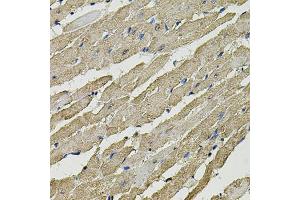 Immunohistochemistry of paraffin-embedded rat heart using SMN2 antibody. (SMN1 antibody)