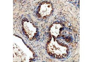 IHC analysis of ALDH1A3 using anti-ALDH1A3 antibody (ABIN5518802). (ALDH1A3 antibody  (AA 37-154))