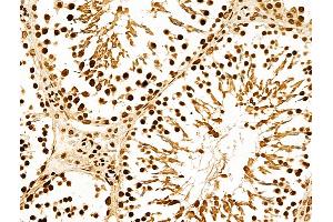 ABIN7094385 and ABIN7098432 at 1/100 staining Rat testis tissue by IHC-P.