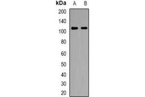 Western blot analysis of NLRX1 expression in HepG2 (A), Hela (B) whole cell lysates. (NLRX1 antibody)