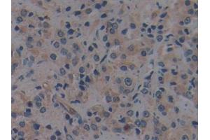 Immunohistochemistry (IHC) image for anti-Toll-Like Receptor 9 (TLR9) (AA 28-362) antibody (ABIN7432445)