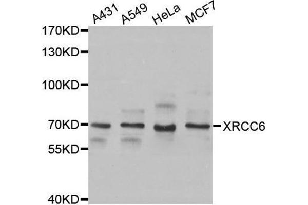 XRCC6 antibody  (AA 500-600)