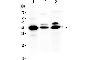 Western blot analysis of IL-1 beta using anti-IL-1 beta antibody . (IL-1 beta antibody  (AA 117-269))