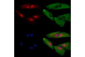 ABIN6259182 and ABIN6273697 staining  cells by IF/ICC.