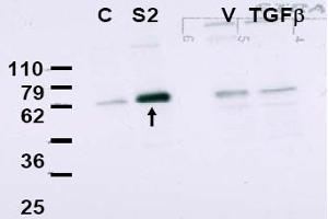 Image no. 1 for anti-SMAD, Mothers Against DPP Homolog 2 (SMAD2) (Internal Region) antibody (ABIN401418) (SMAD2 antibody  (Internal Region))