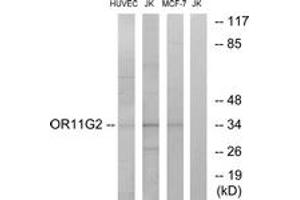 Western blot analysis of extracts from HuvEc/Jurkat/MCF-7 cells, using OR11G2 Antibody. (OR11G2 antibody  (AA 241-290))