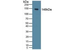 Detection of PIK3Cd in Mouse Liver Tissue using Polyclonal Antibody to Phosphoinositide-3-Kinase Catalytic Delta Polypeptide (PIK3Cd) (PIK3CD antibody  (AA 774-1044))