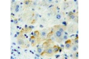 Used in DAB staining on fromalin fixed paraffin-embedded Liver tissue (PVRL2 antibody  (AA 83-291))