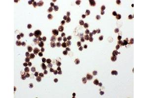 ICC testing of WISP1 antibody and MCF-7 cells (WISP1 antibody  (C-Term))
